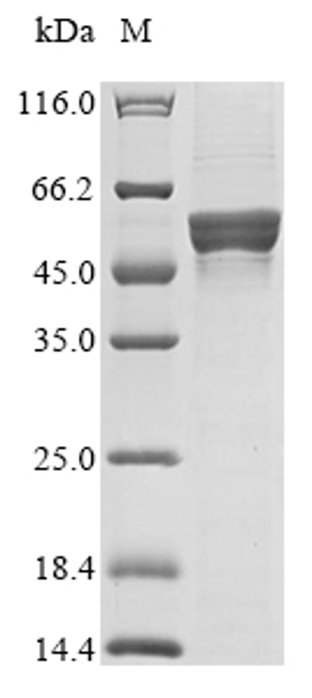 (Tris-Glycine gel) Discontinuous SDS-PAGE (reduced) with 5% enrichment gel and 15% separation gel.