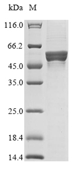(Tris-Glycine gel) Discontinuous SDS-PAGE (reduced) with 5% enrichment gel and 15% separation gel.