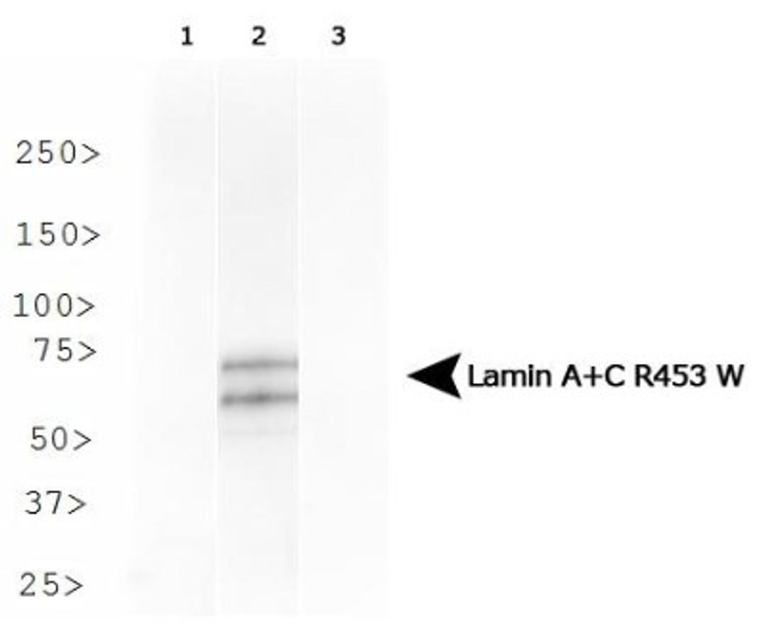 Western Blot: Lamin A + C R453W Antibody (12A-2F5) [NBP1-77401] - Analysis of Lamin A + C R453W in HeLa cells transfected with Flag-tagged Lamin A 1) wild type, 2) R453W and 3) R482W.