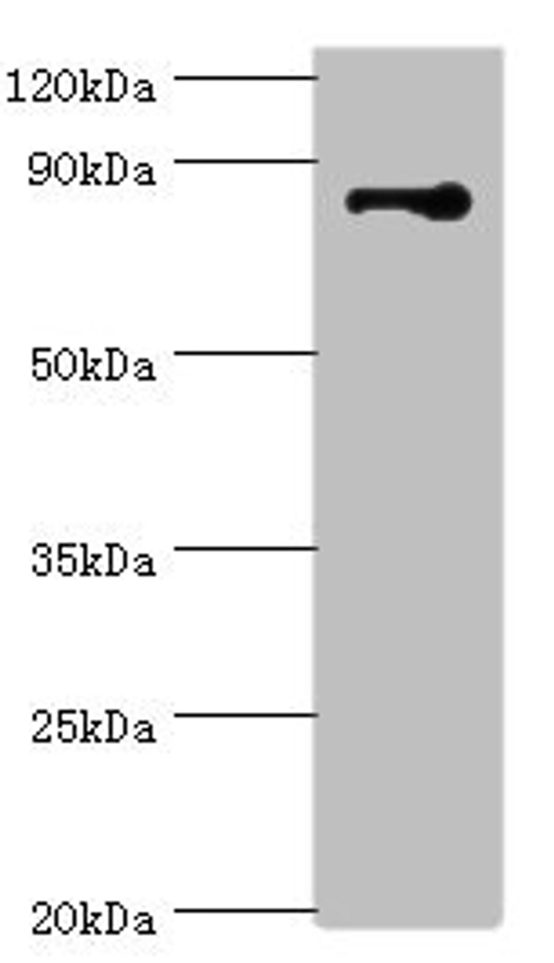 Western blot. All lanes: STRN antibody at 3ug/ml + NIH/3T3 whole cell lysate. Secondary. Goat polyclonal to rabbit IgG at 1/10000 dilution. Predicted band size: 87, 81 kDa. Observed band size: 87 kDa. 