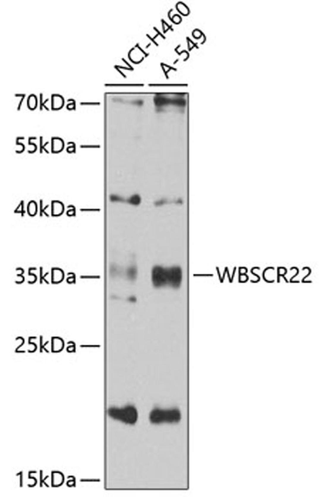 Western blot - WBSCR22 antibody (A7317)