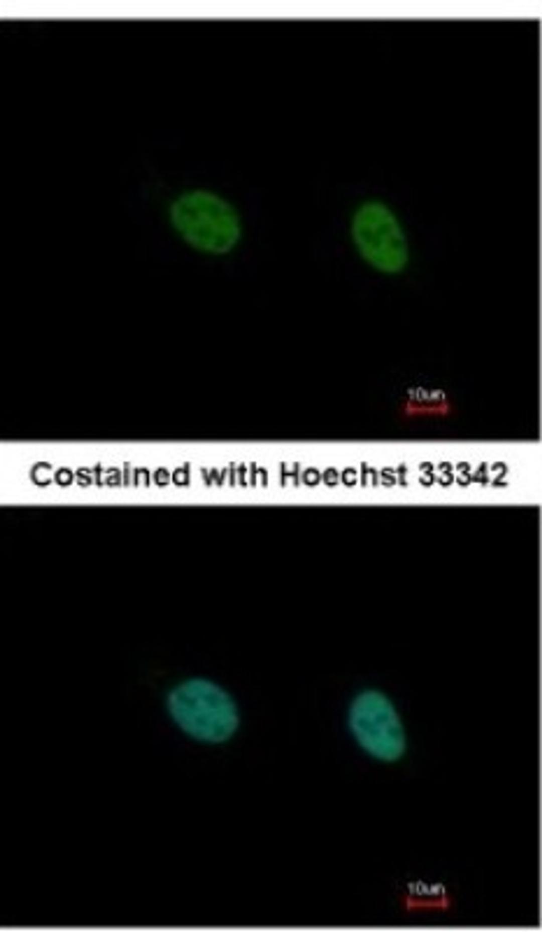 Immunocytochemistry/Immunofluorescence: DAZ3 Antibody [NBP2-16103] - Analysis of paraformaldehyde-fixed HeLa, using antibody at 1:500 dilution.