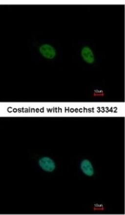 Immunocytochemistry/Immunofluorescence: DAZ3 Antibody [NBP2-16103] - Analysis of paraformaldehyde-fixed HeLa, using antibody at 1:500 dilution.