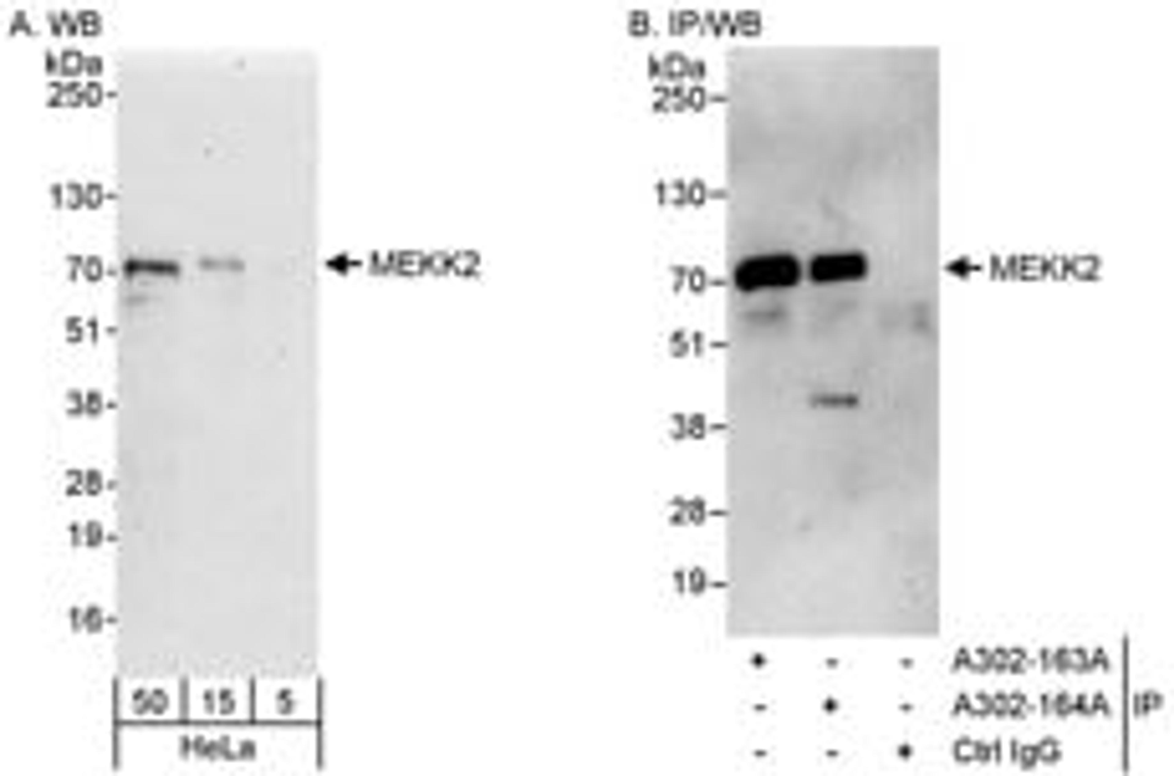 Detection of human MEKK2 by western blot and immunoprecipitation.