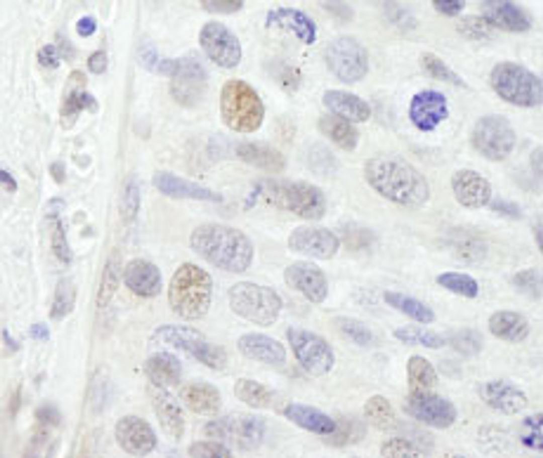 Detection of human NBS1 by immunohistochemistry.