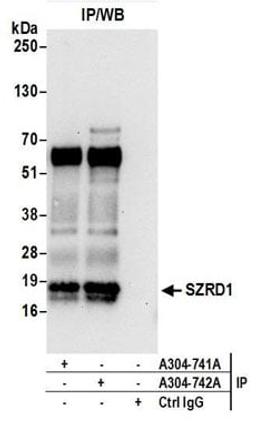 Detection of human SZRD1 by western blot of immunoprecipitates.