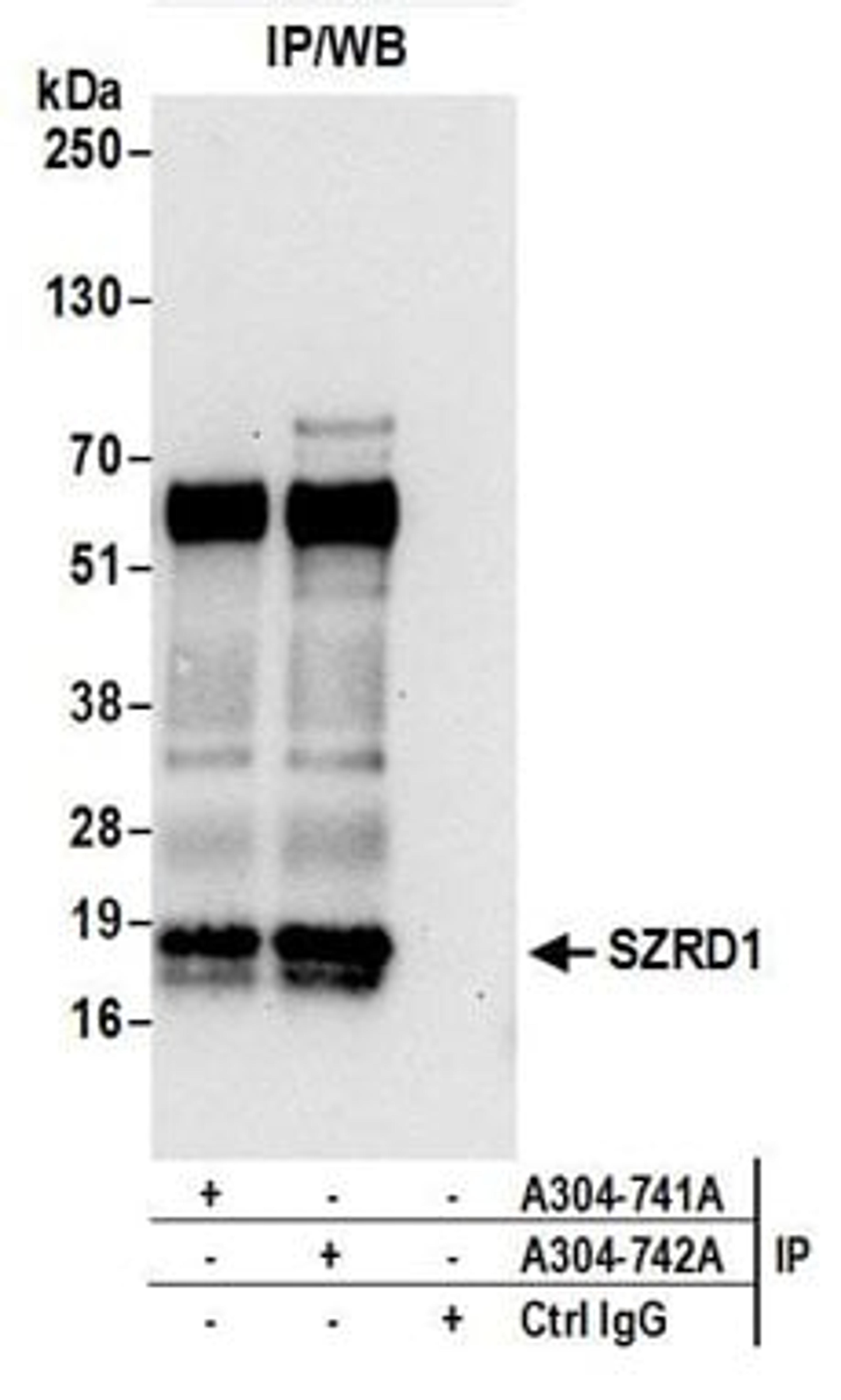 Detection of human SZRD1 by western blot of immunoprecipitates.