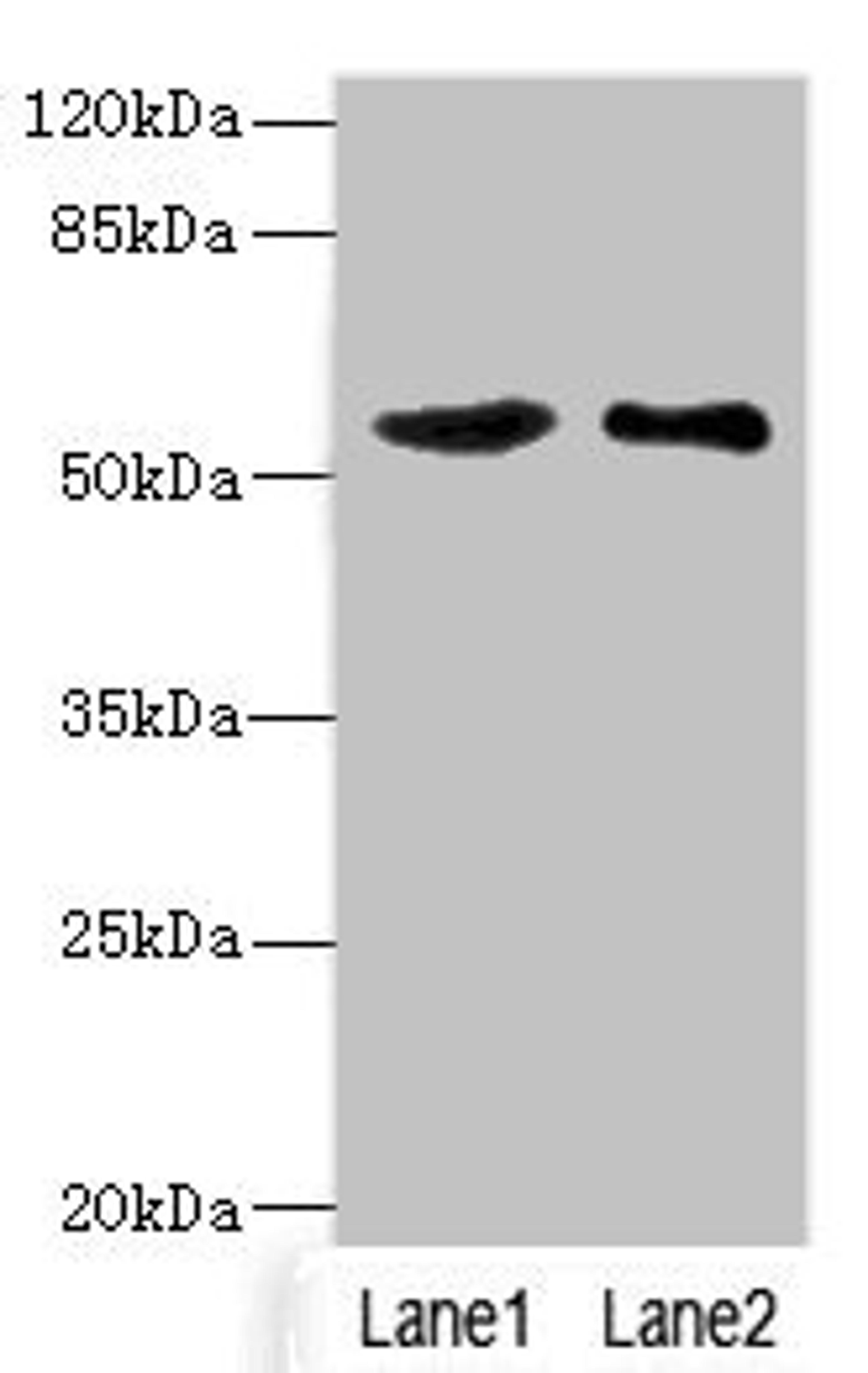 Western blot. All lanes: SLC30A1 antibody at 3.75ug/ml. Lane 1: A549 whole cell lysate. Lane 2: HepG2 whole cell lysate. Secondary. Goat polyclonal to rabbit IgG at 1/10000 dilution. Predicted band size: 55 kDa. Observed band size: 55 kDa. 