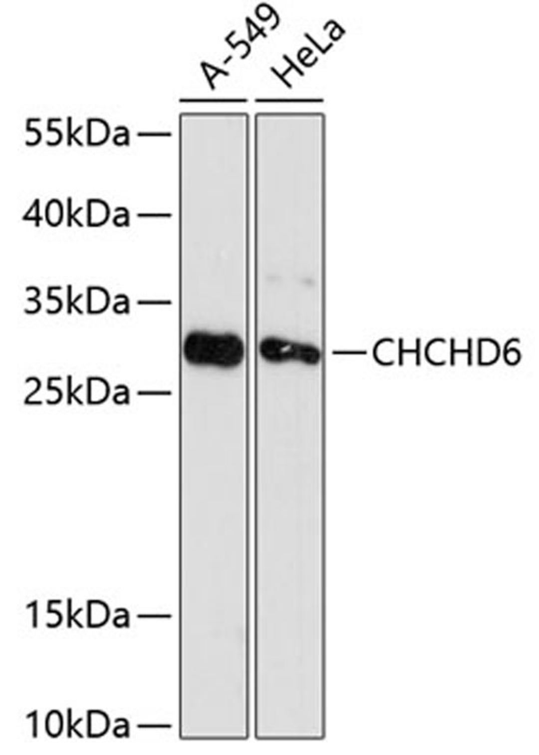 Western blot - CHCHD6 antibody (A12911)