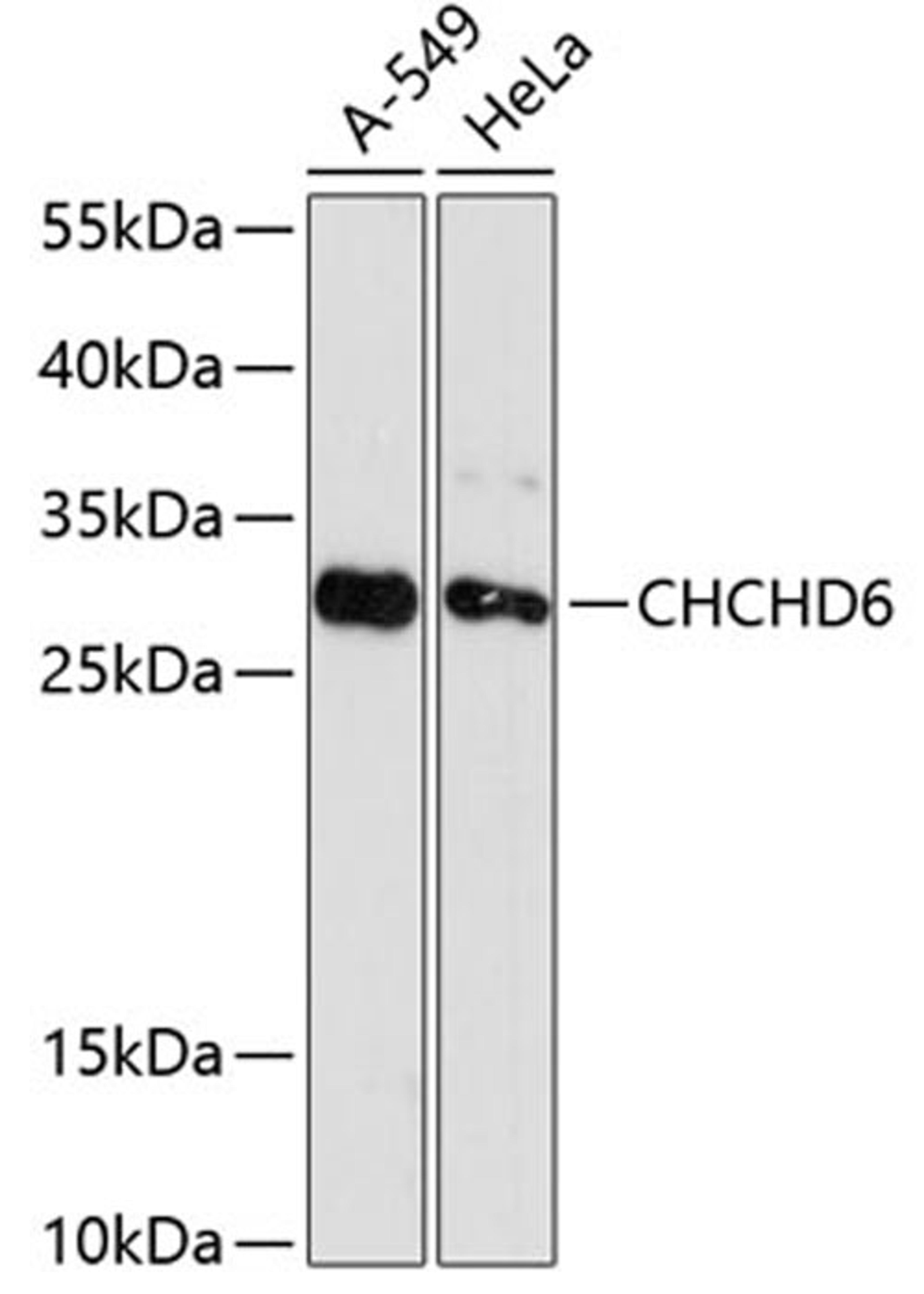 Western blot - CHCHD6 antibody (A12911)