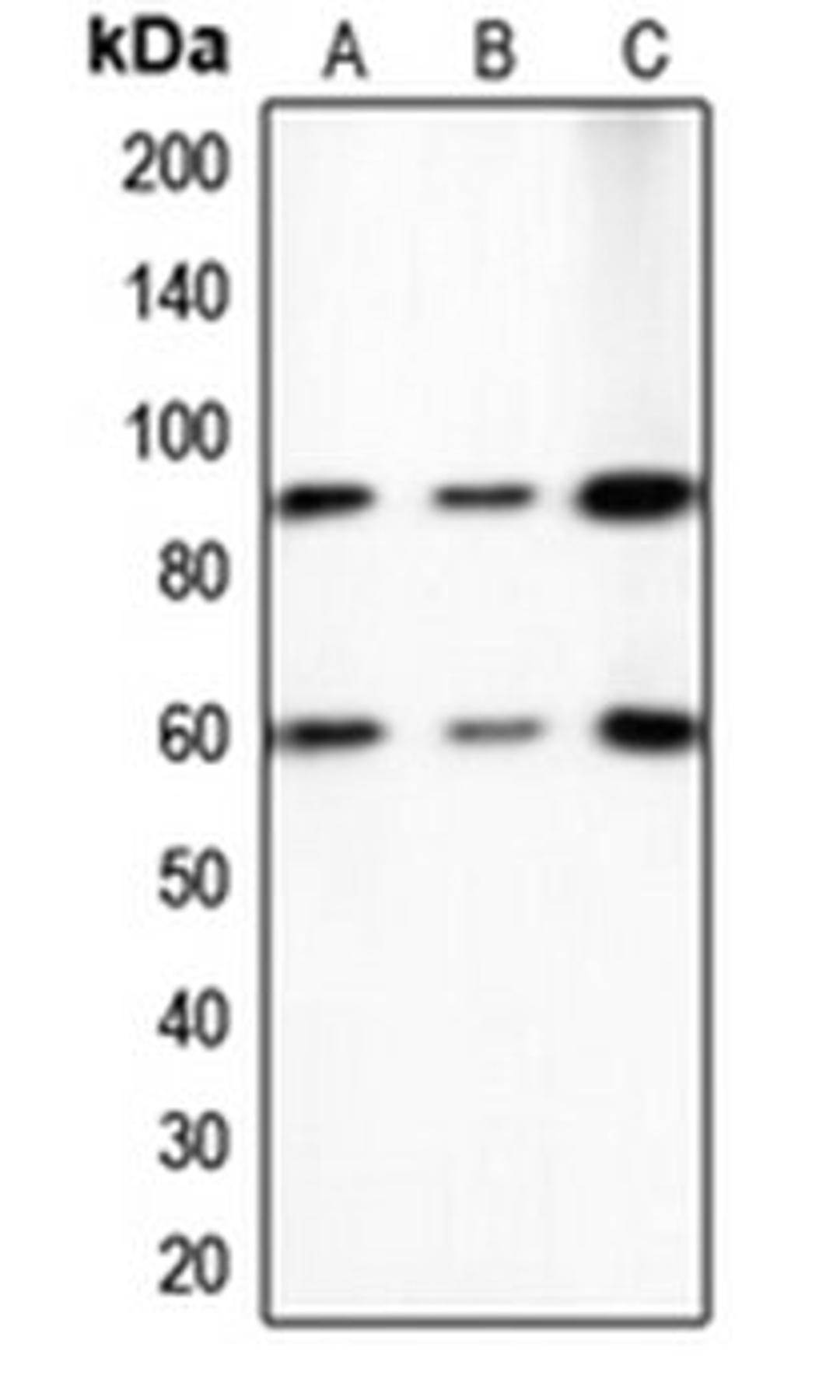 Western blot analysis of A431 (Lane 1), HeLa (Lane 2), NIH3T3 (Lane 3) whole cell lysates using ERF antibody