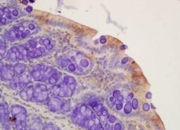 Immunohistochemical analysis of formalin-fixed paraffin embedded rat colon tissue using OST beta antibody (dilution at 1:200)