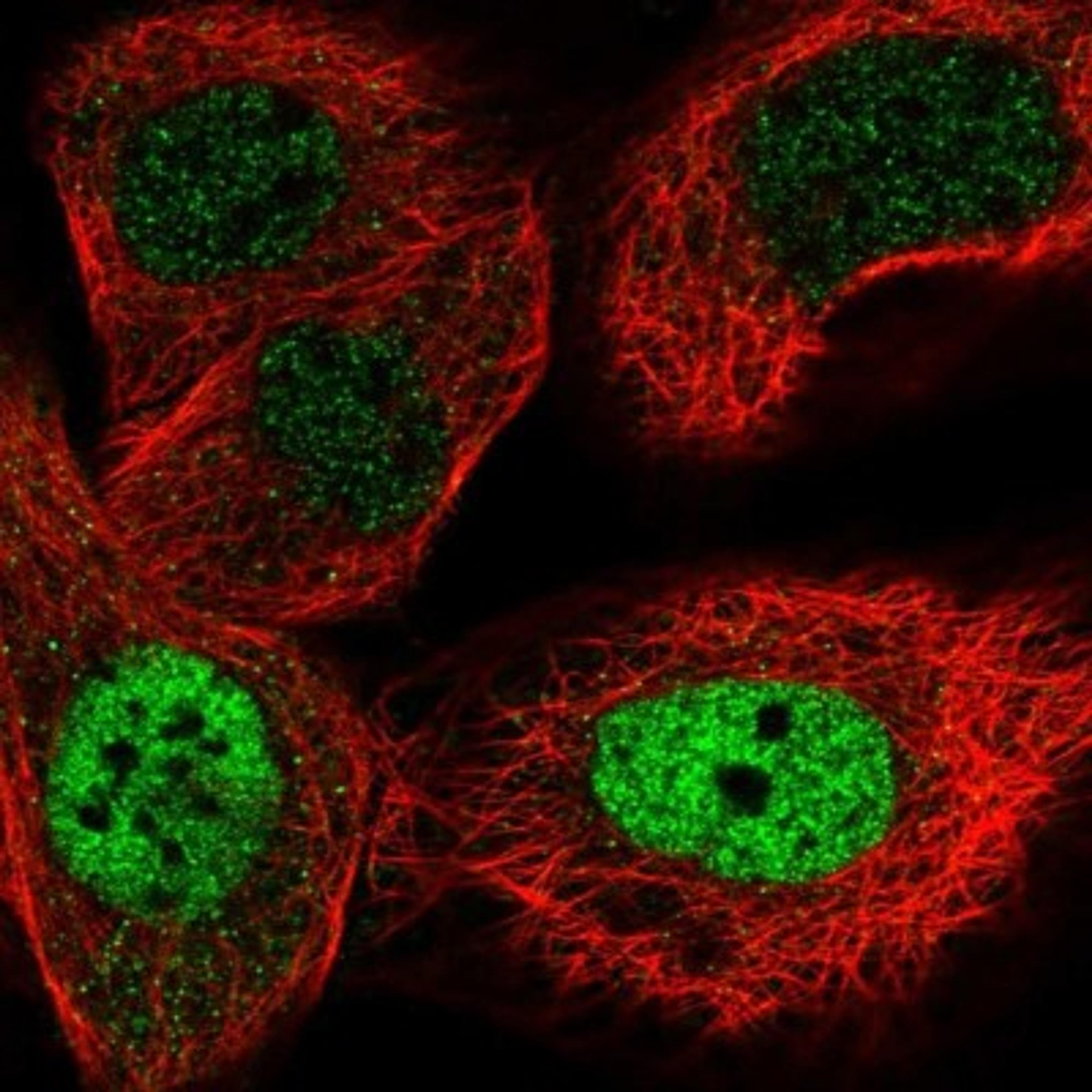 Immunocytochemistry/Immunofluorescence: ZNF426 Antibody [NBP1-81149] - Staining of human cell line A-431 shows positivity in nucleus but not nucleoli.