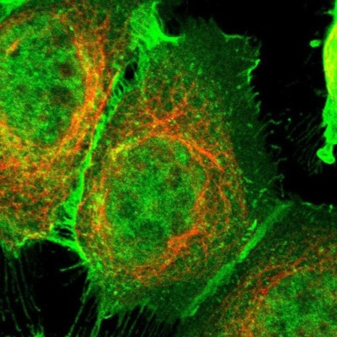 Immunocytochemistry/Immunofluorescence: RG9MTD3 Antibody [NBP1-88770] - Staining of human cell line A-431 shows positivity in nucleus but not nucleoli, plasma membrane & cell junctions.