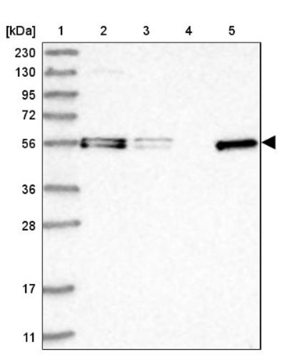 Western Blot: FAM98A Antibody [NBP2-38291] - Lane 1: Marker [kDa] 230, 130, 95, 72, 56, 36, 28, 17, 11<br/>Lane 2: RT-4<br/>Lane 3: U-251 MG<br/>Lane 4: Human Plasma<br/>Lane 5: Liver