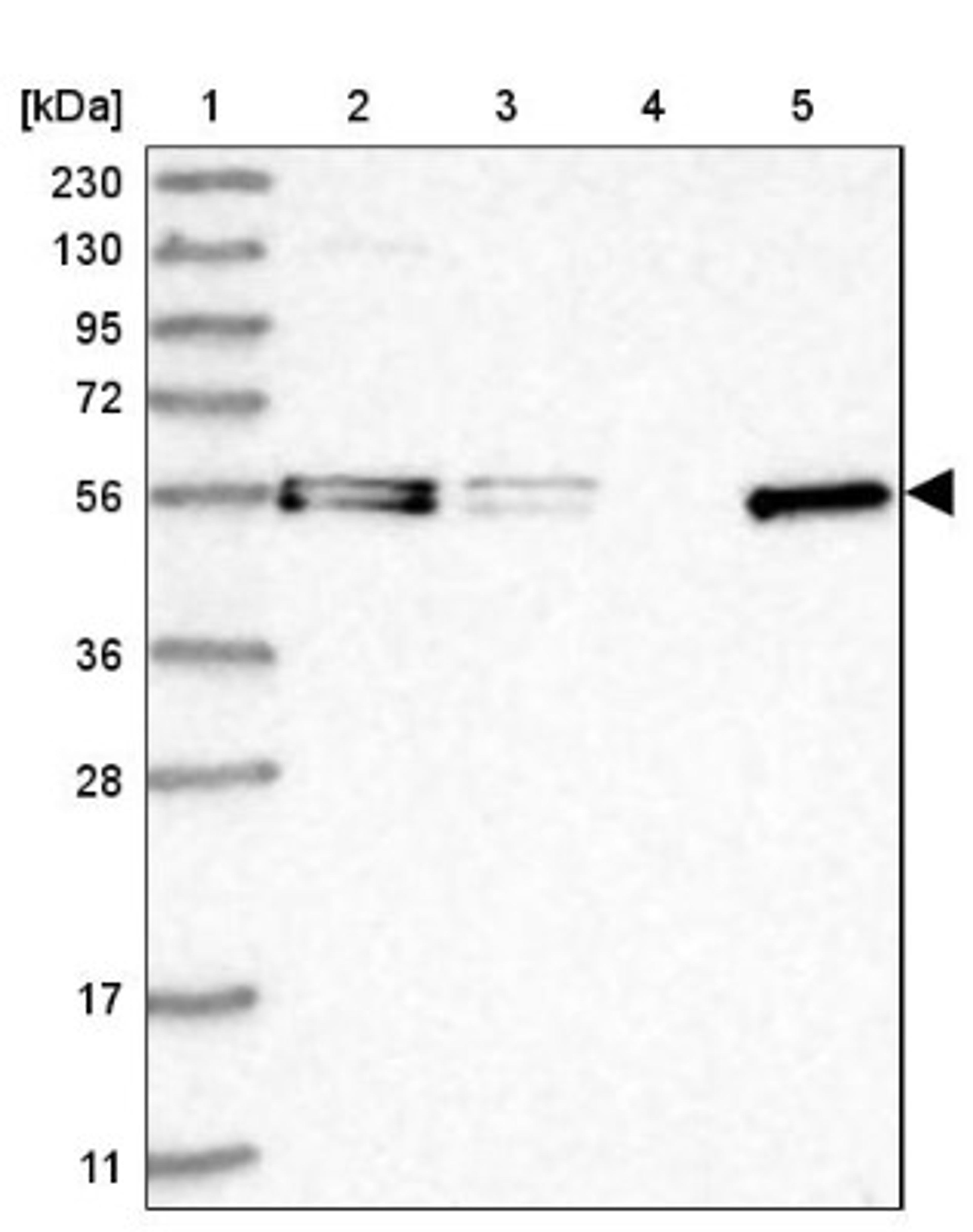 Western Blot: FAM98A Antibody [NBP2-38291] - Lane 1: Marker [kDa] 230, 130, 95, 72, 56, 36, 28, 17, 11<br/>Lane 2: RT-4<br/>Lane 3: U-251 MG<br/>Lane 4: Human Plasma<br/>Lane 5: Liver