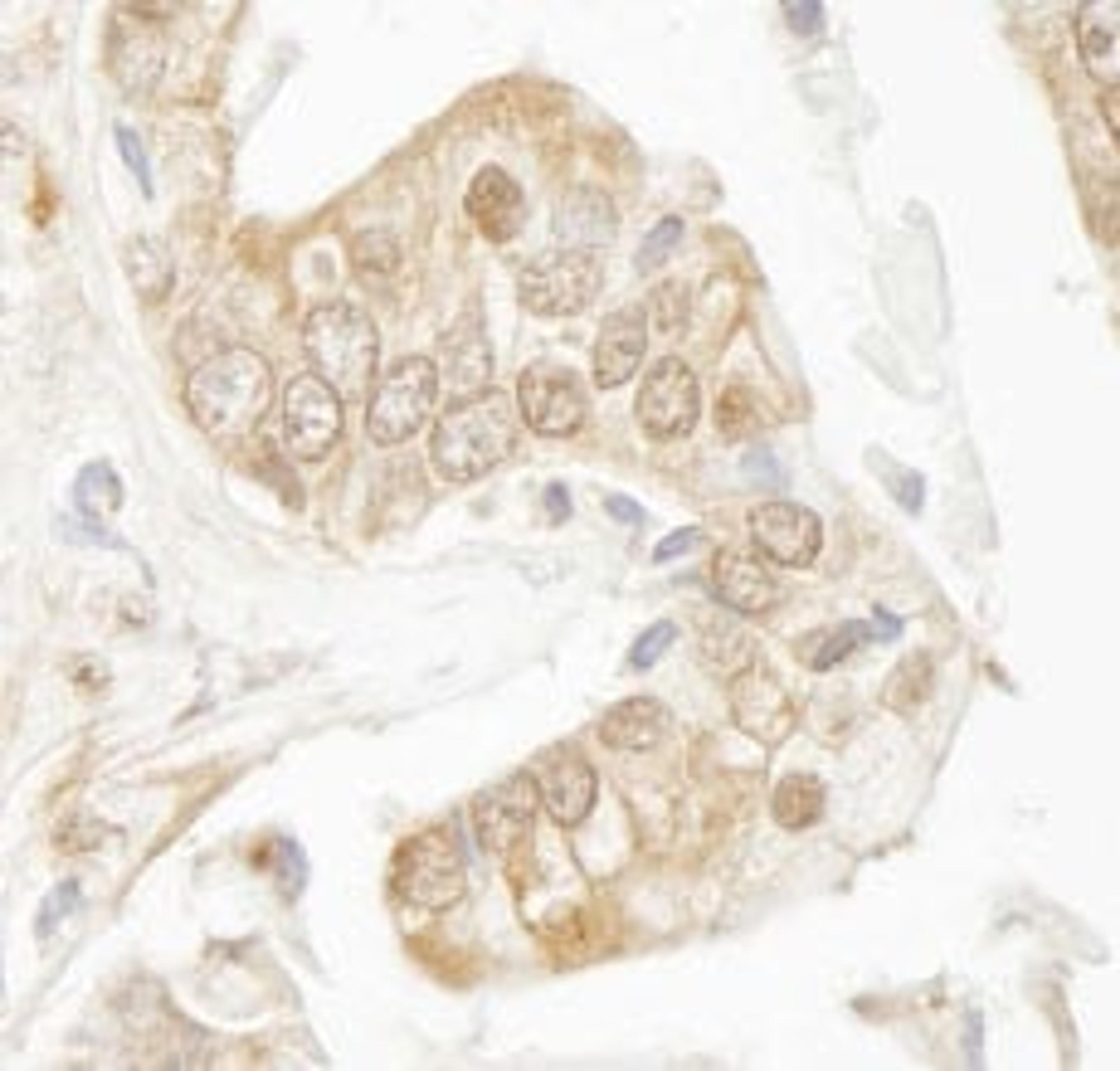 Detection of human Rad9 by immunohistochemistry.