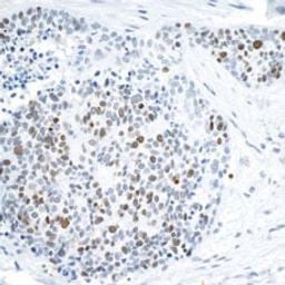 Detection of human FALZ/BPTF by immunohistochemistry.