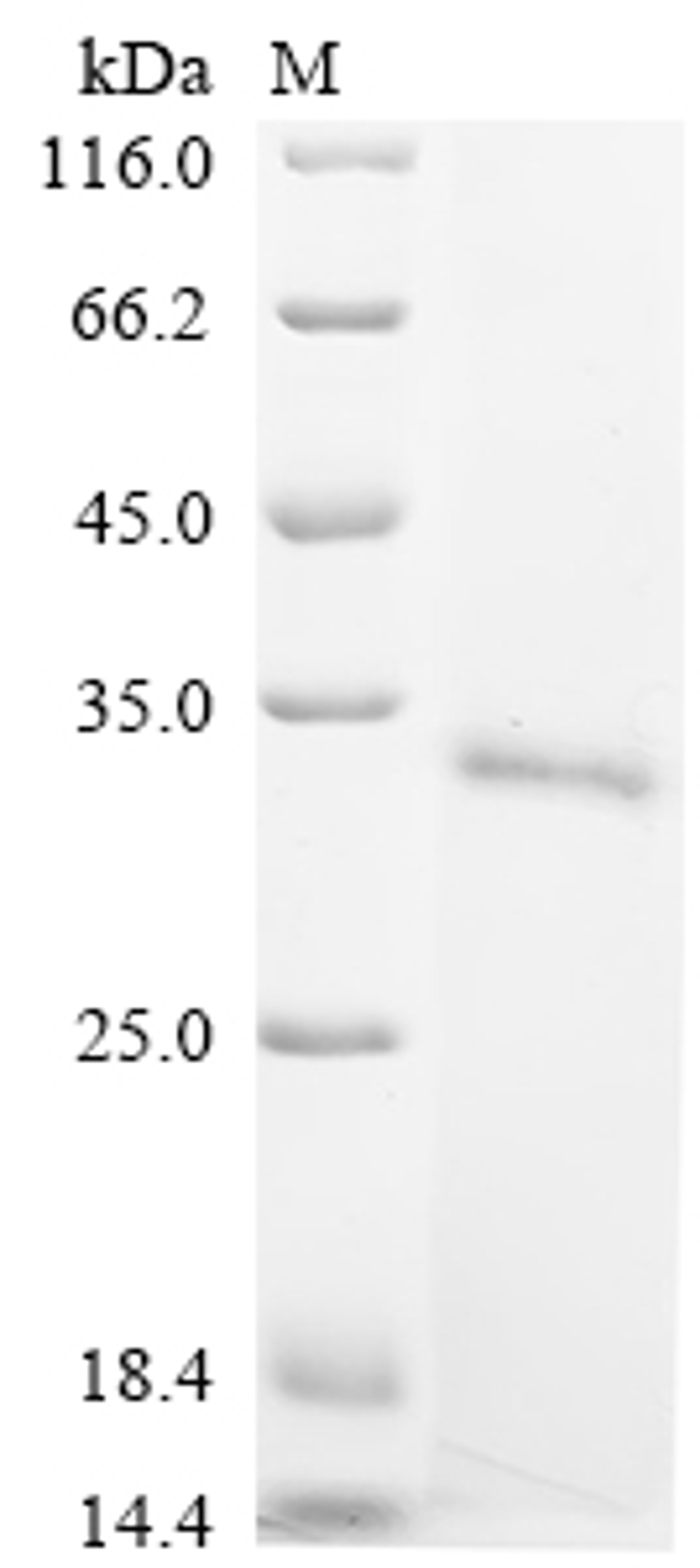 (Tris-Glycine gel) Discontinuous SDS-PAGE (reduced) with 5% enrichment gel and 15% separation gel.