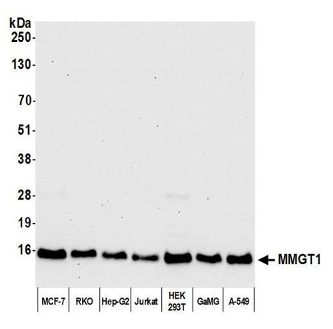 Detection of human MMGT1 by WB.