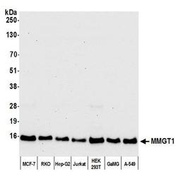 Detection of human MMGT1 by WB.