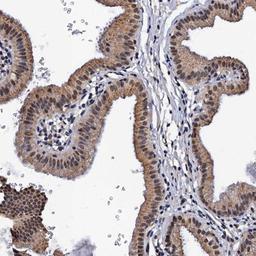 Immunohistochemistry-Paraffin: MYLK3 Antibody [NBP1-86648] - Staining of human gall bladder shows moderate cytoplasmic and nuclear positivity in glandular cells.