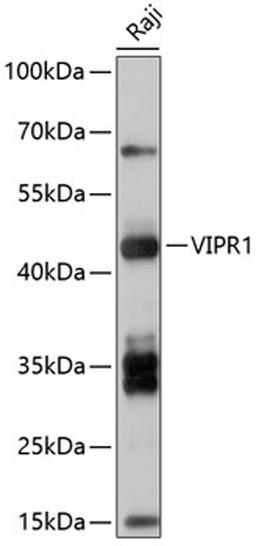 Western blot - VIPR1 antibody (A10515)