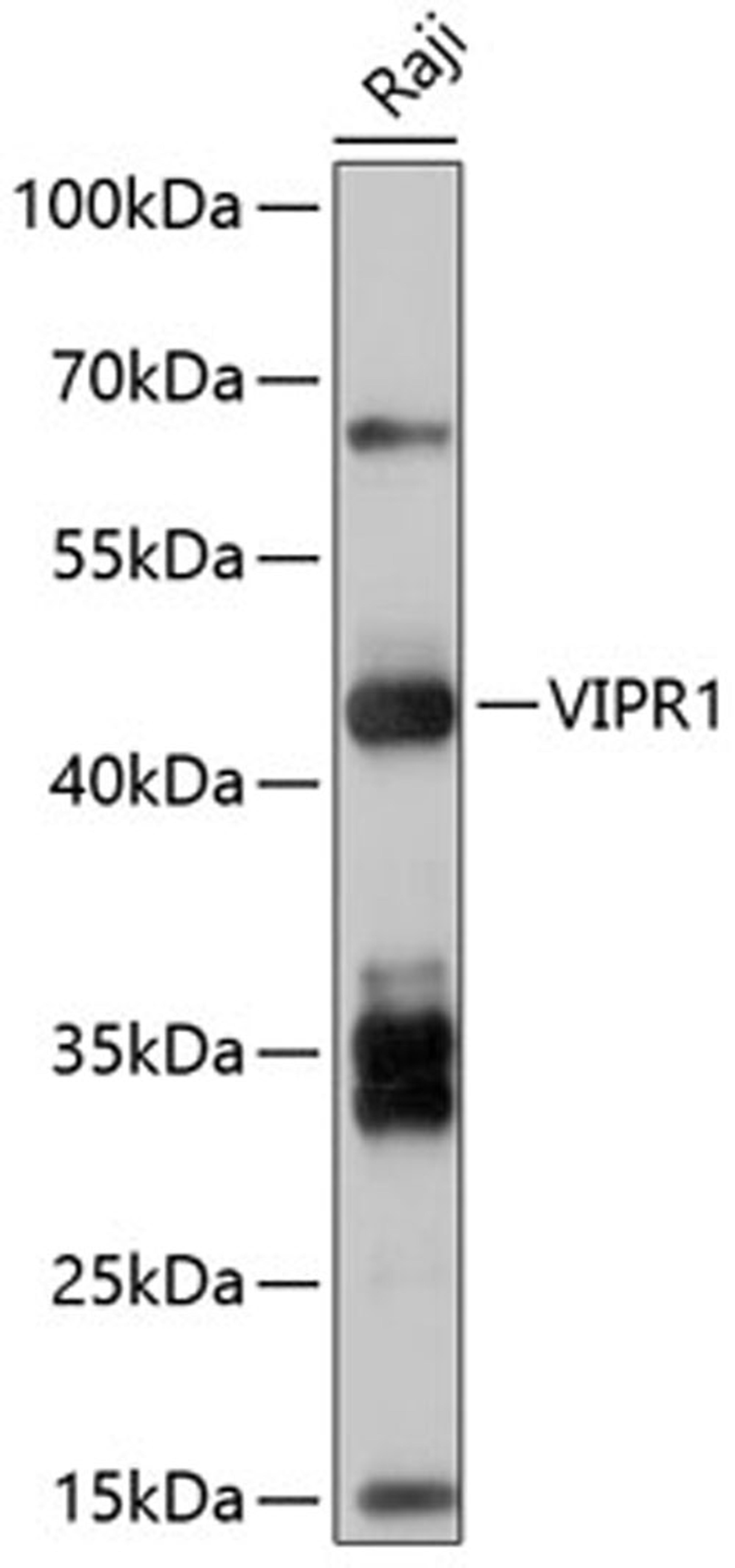 Western blot - VIPR1 antibody (A10515)