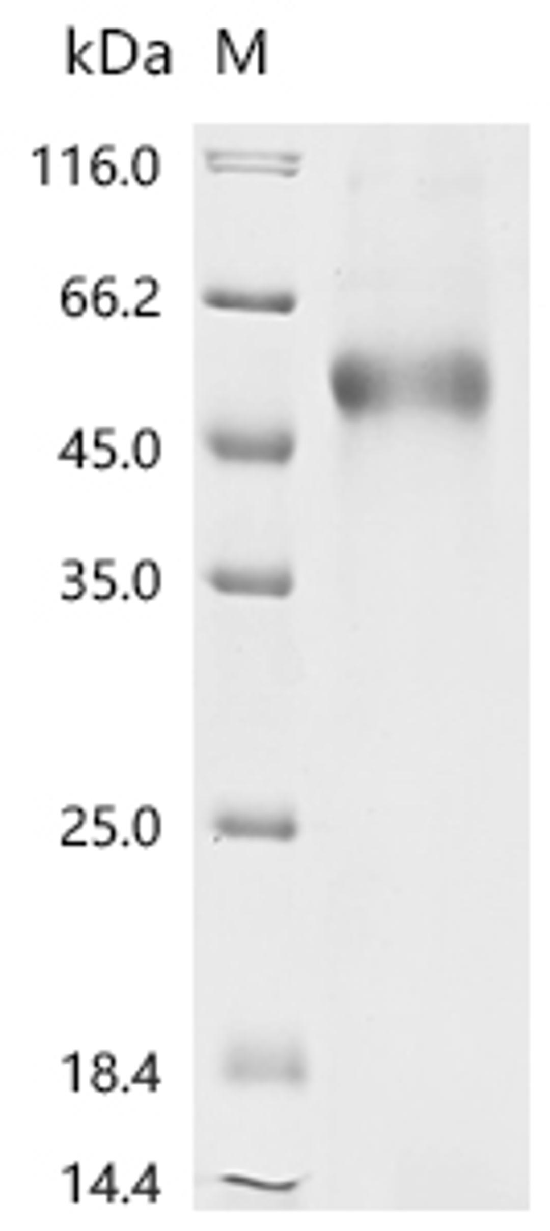 (Tris-Glycine gel) Discontinuous SDS-PAGE (reduced) with 5% enrichment gel and 15% separation gel.