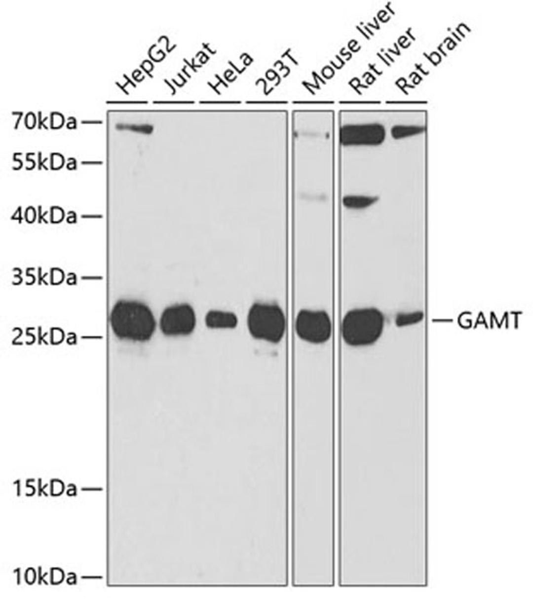 Western blot - GAMT antibody (A6597)