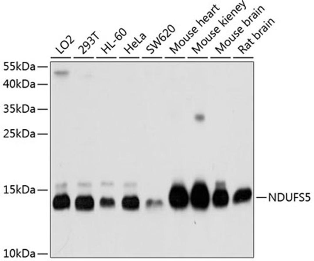 Western blot - NDUFS5 antibody (A1265)