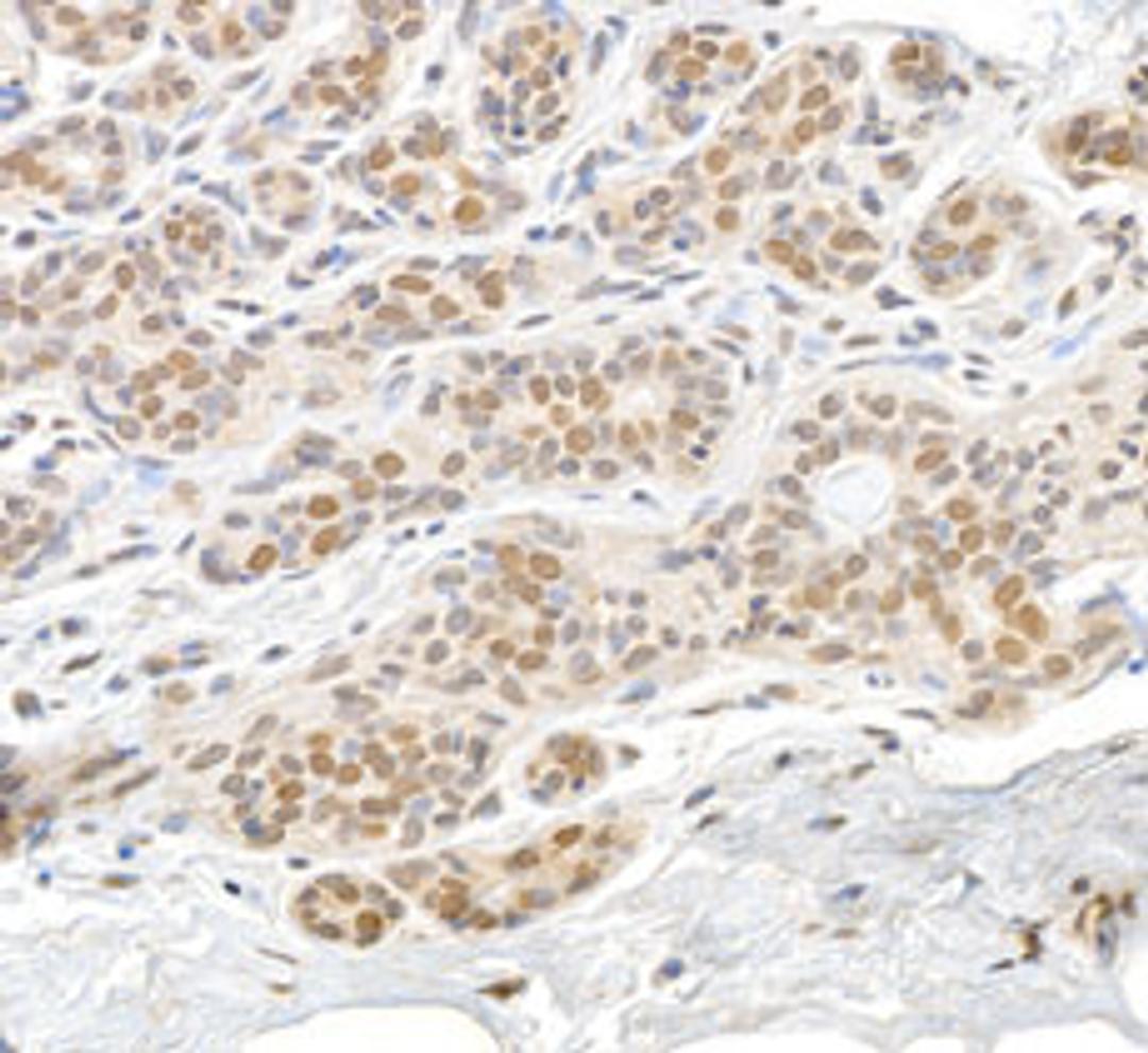 Detection of human RAN by immunohistochemistry. 