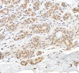 Detection of human RAN by immunohistochemistry. 