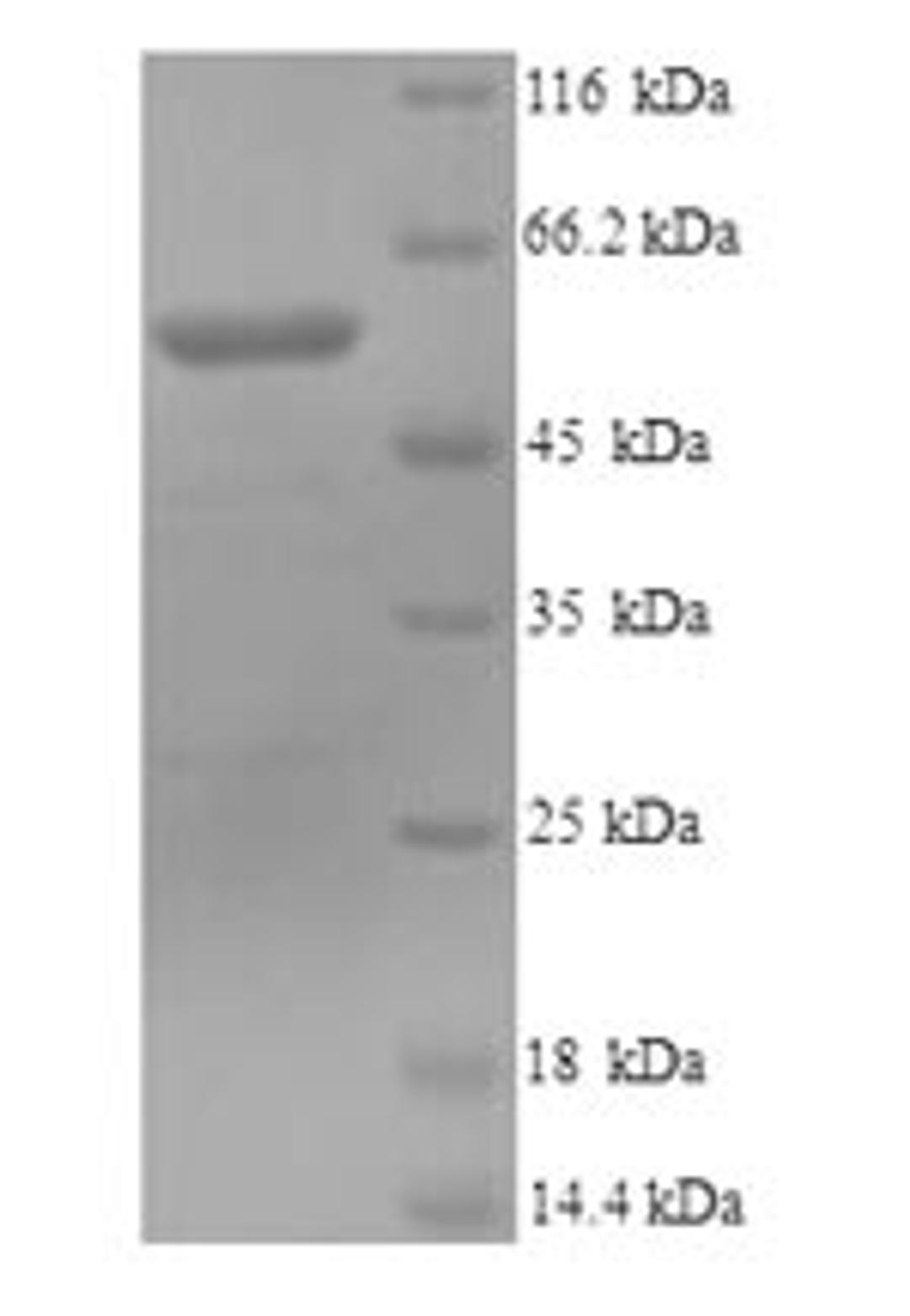(Tris-Glycine gel) Discontinuous SDS-PAGE (reduced) with 5% enrichment gel and 15% separation gel.