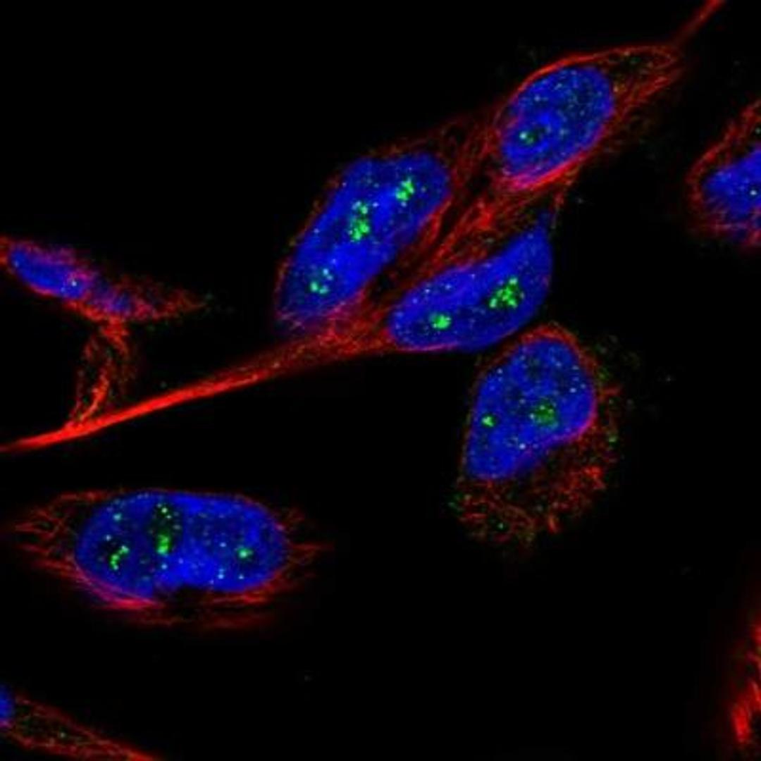 Immunofluorescence: B3GNTL1 Antibody [NBP1-90838] - Analysis of human cell line U-251 MG shows positivity in nucleoli. Antibody staining is shown in green.