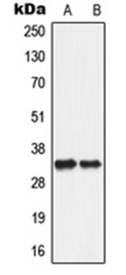 Western blot analysis of A549 (Lane 1), PC12 (Lane 2) whole cell lysates using SLC25A5 antibody