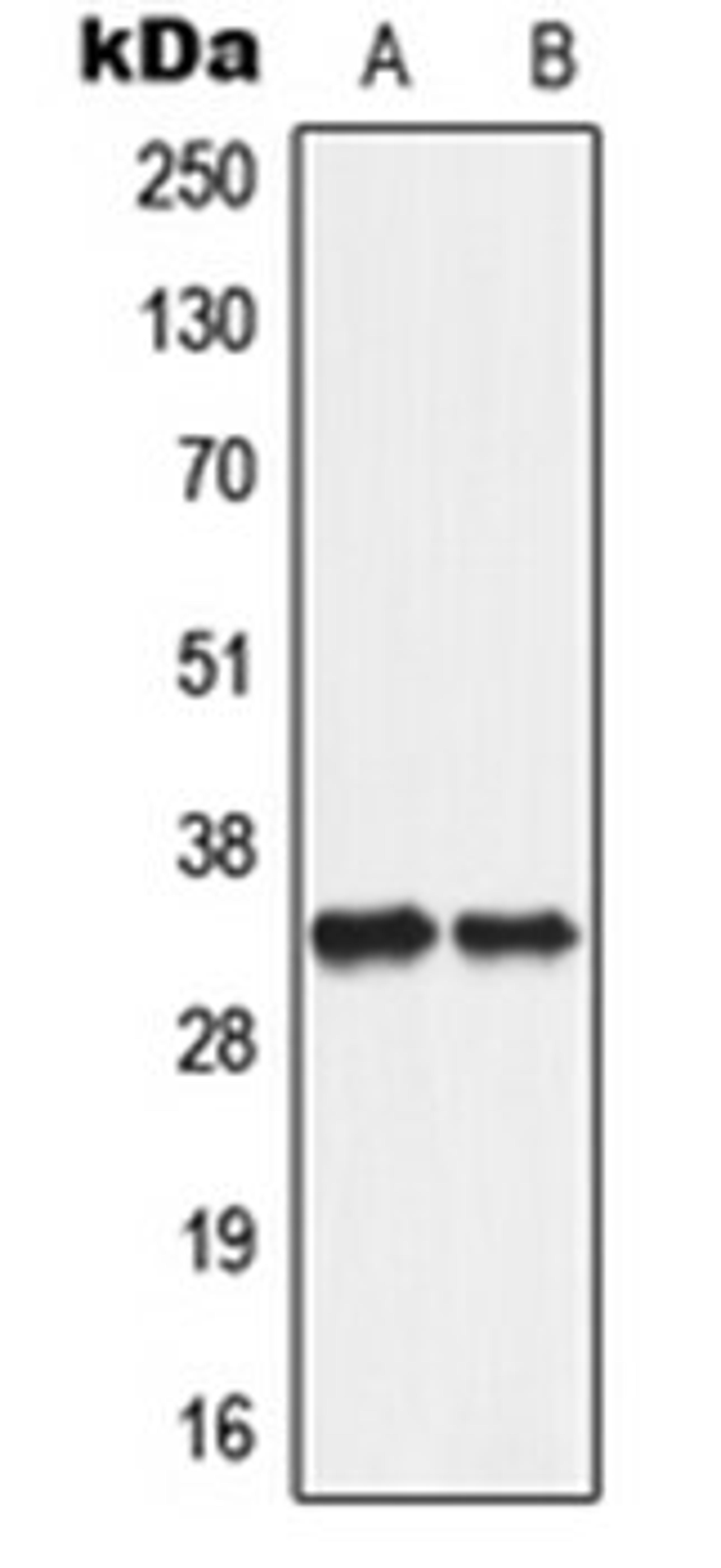 Western blot analysis of A549 (Lane 1), PC12 (Lane 2) whole cell lysates using SLC25A5 antibody