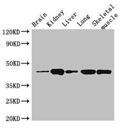 Western Blot. Positive WB detected in: Mouse brain tissue, Mouse kidney tissue, Mouse liver tissue, Rat lung tissue, Rat skeletal muscle tissue. All lanes: P2RX4 antibody at 3ug/ml. Secondary. Goat polyclonal to rabbit IgG at 1/50000 dilution. Predicted band size: 44, 46, 41 kDa. Observed band size: 44 kDa. 