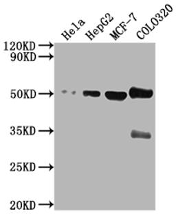 Western Blot. Positive WB detected in: Hela whole cell lysate, HepG2 whole cell lysate, MCF-7 whole cell lysate, COLO320 whole cell lysate. All lanes: CALR antibody at 1:2000. Secondary. Goat polyclonal to rabbit IgG at 1/50000 dilution. Predicted band size: 49 kDa. Observed band size: 49 kDa. 