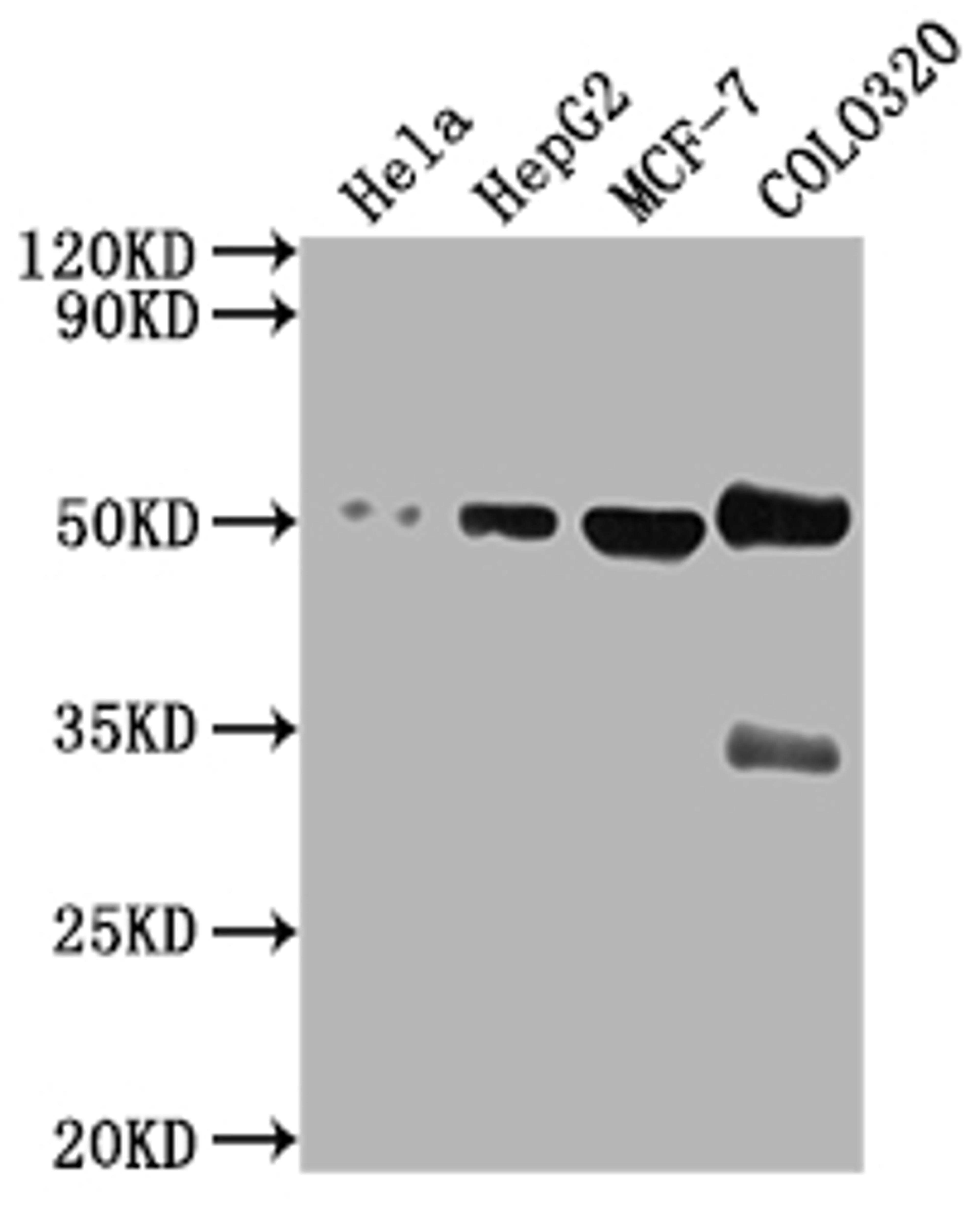 Western Blot. Positive WB detected in: Hela whole cell lysate, HepG2 whole cell lysate, MCF-7 whole cell lysate, COLO320 whole cell lysate. All lanes: CALR antibody at 1:2000. Secondary. Goat polyclonal to rabbit IgG at 1/50000 dilution. Predicted band size: 49 kDa. Observed band size: 49 kDa. 