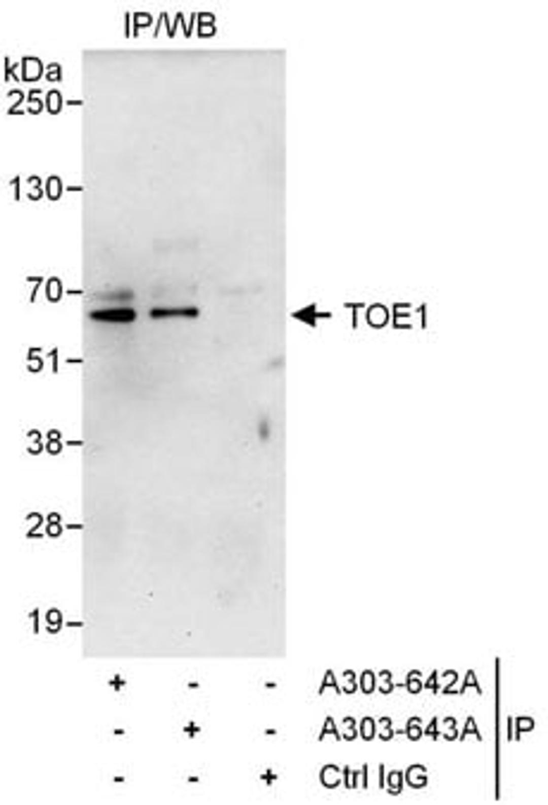 Detection of human TOE1 by western blot of immunoprecipitates.