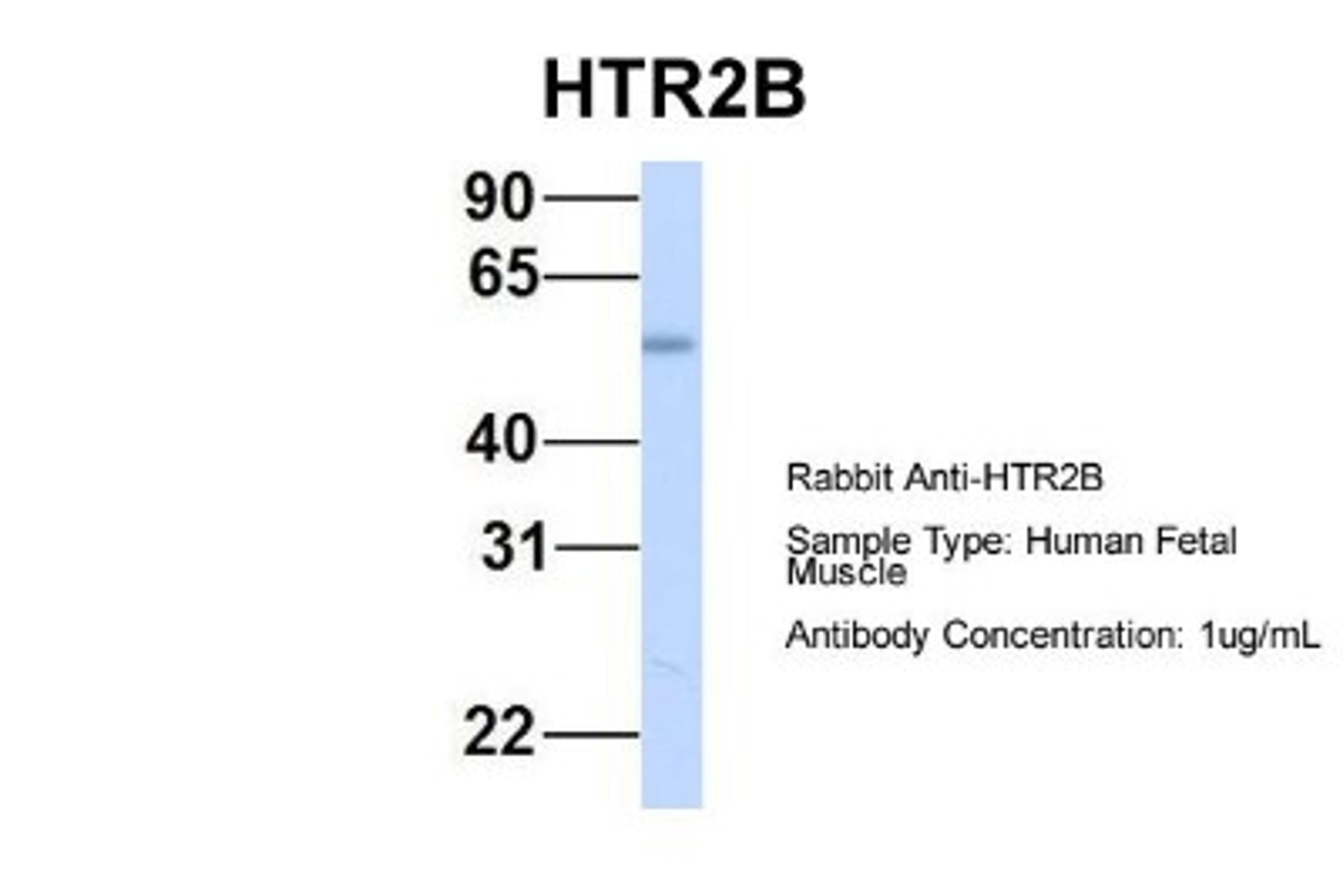 Western Blot: 5-HT2B Antibody [NBP1-55429] - Human Fetal Muscle, Antibody Dilution: 1.0 ug/ml.