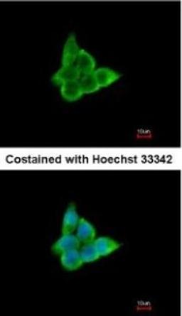 Immunocytochemistry/Immunofluorescence: CISH/CIS-1 Antibody [NBP1-30943] - Paraformaldehyde-fixed A431, using antibody at 1:200 dilution.