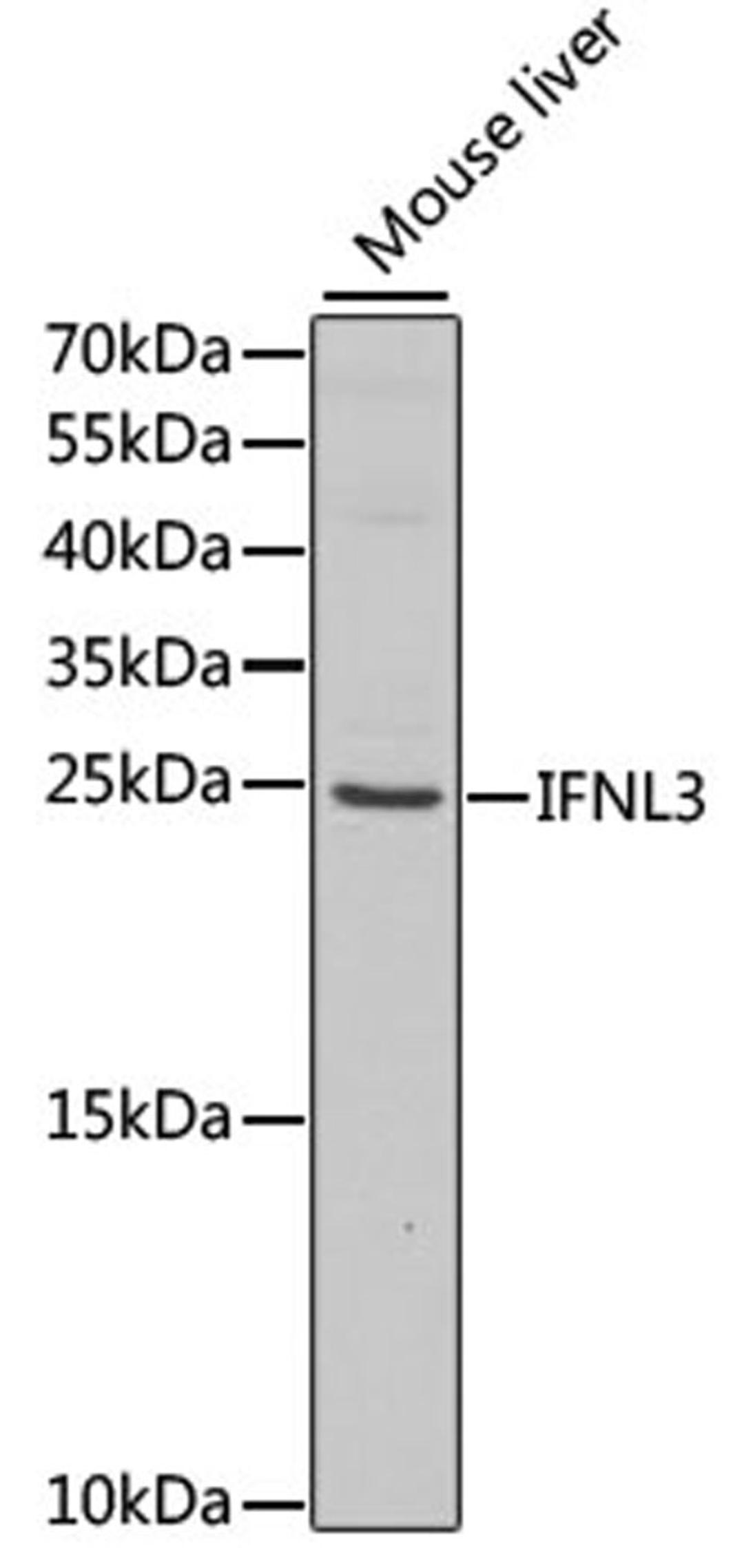 Western blot - IFNL3 antibody (A5648)