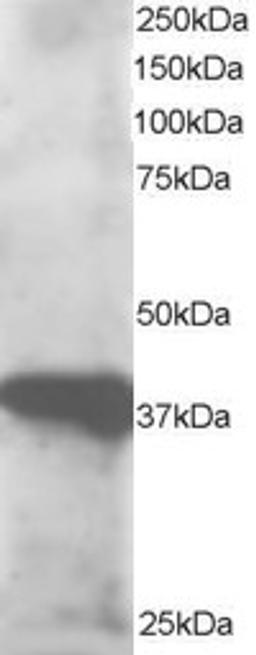 45-671 staining (0.5ug/ml) of human lymph node lysate (RIPA buffer, 30ug total protein per lane). Primary incubated for 1 hour. Detected by western blot using chemiluminescence.