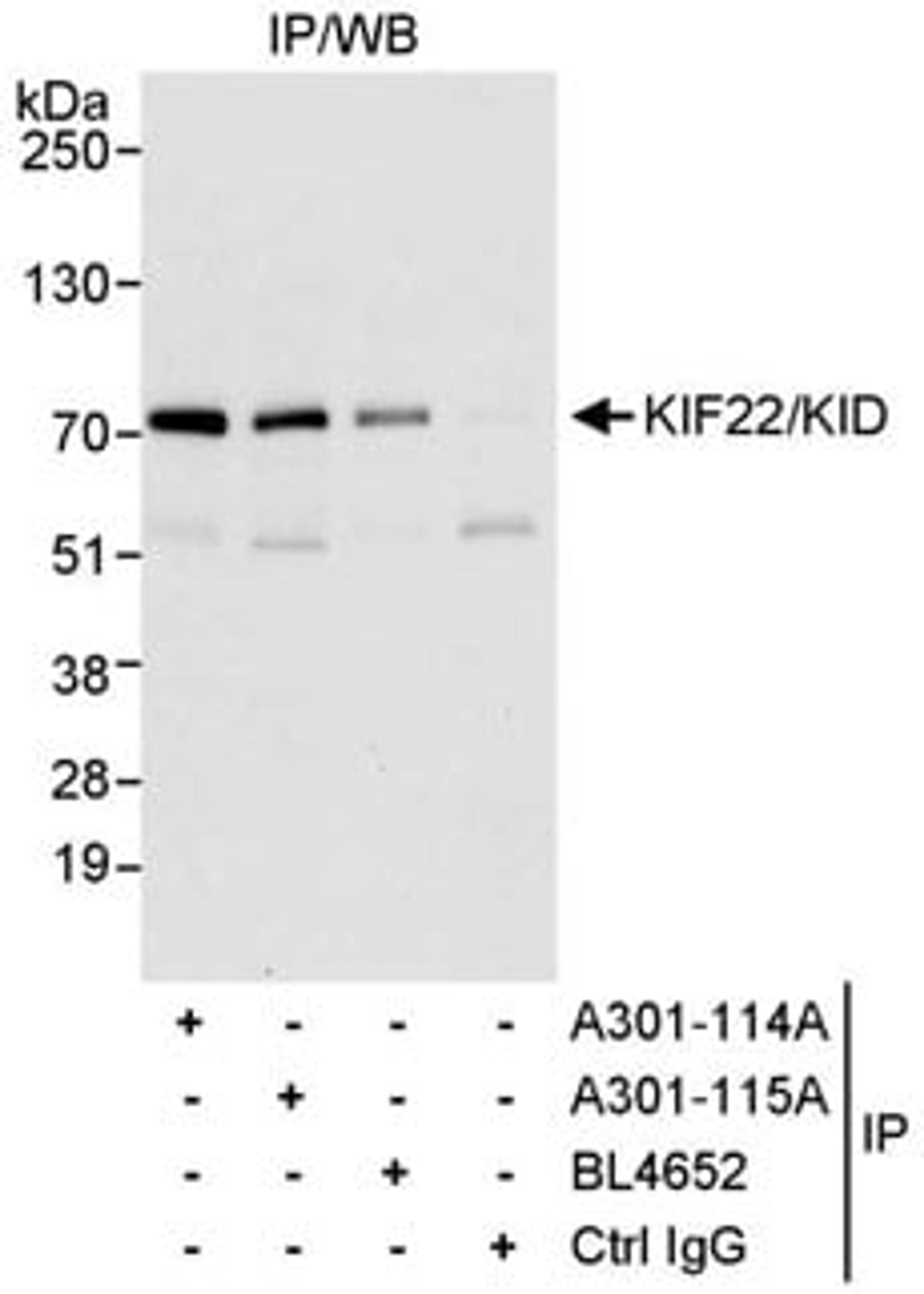 Detection of human KIF22/KID by western blot of immunoprecipitates.