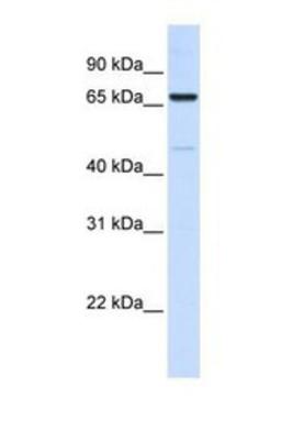 Western Blot: ACSL5 Antibody [NBP1-59645] - Human placenta tissue lysate at a concentration of 1ug/ml.