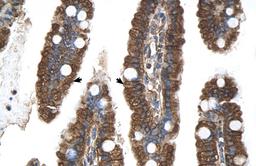 Antibody used in IHC on Human Intestine.