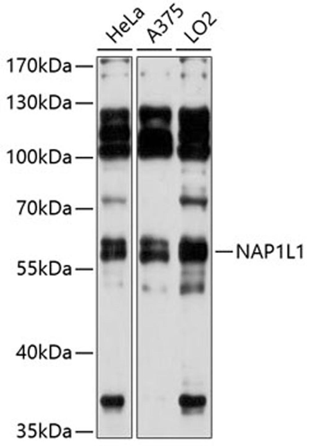 Western blot - NAP1L1 Antibody (A11610)