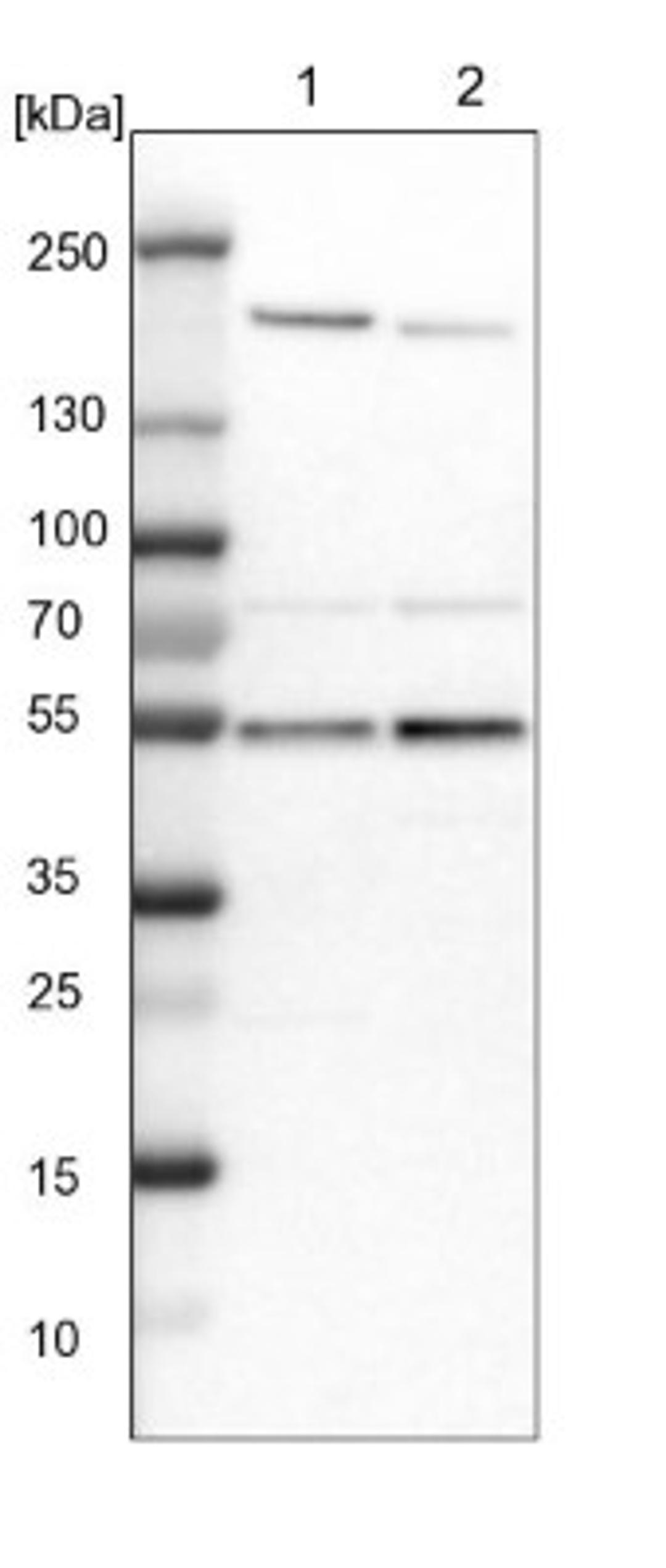 Western Blot: smu1 Antibody [NBP1-88522] - Lane 1: NIH-3T3 cell lysate (Mouse embryonic fibroblast cells)<br/>Lane 2: NBT-II cell lysate (Rat Wistar bladder tumour cells)